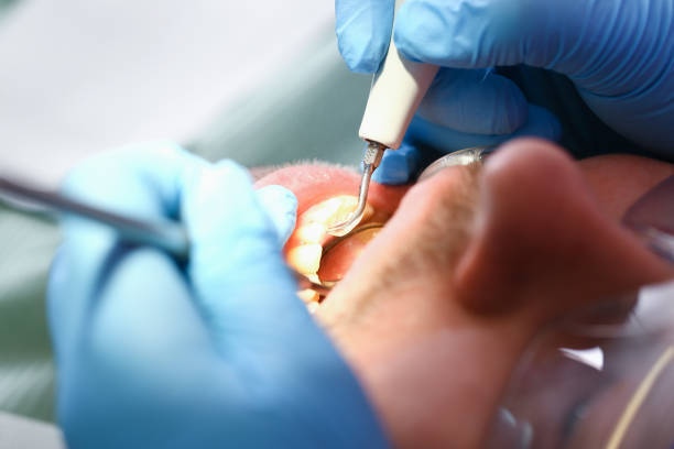 Best Emergency Dental Services for Seniors in Woodville, TX